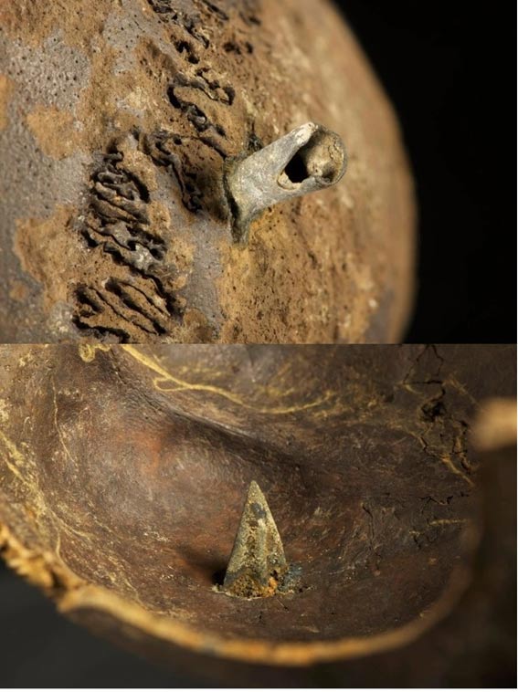 Un teschio che è stato trovato con una punta di freccia di bronzo trovato saldamente radicata in essa, entrare nel cervello.