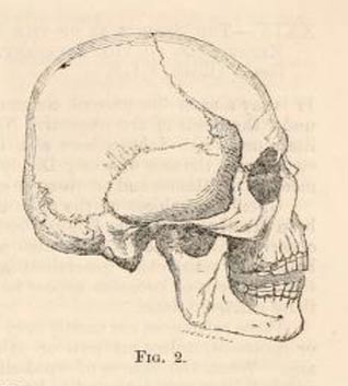 Brachycephalic Beaker skull from the Natural History Review, 1862. Courtesy Archive.org.