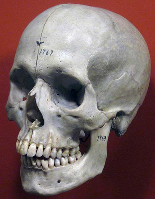Homo sapiens skull (Holocene) 3. 