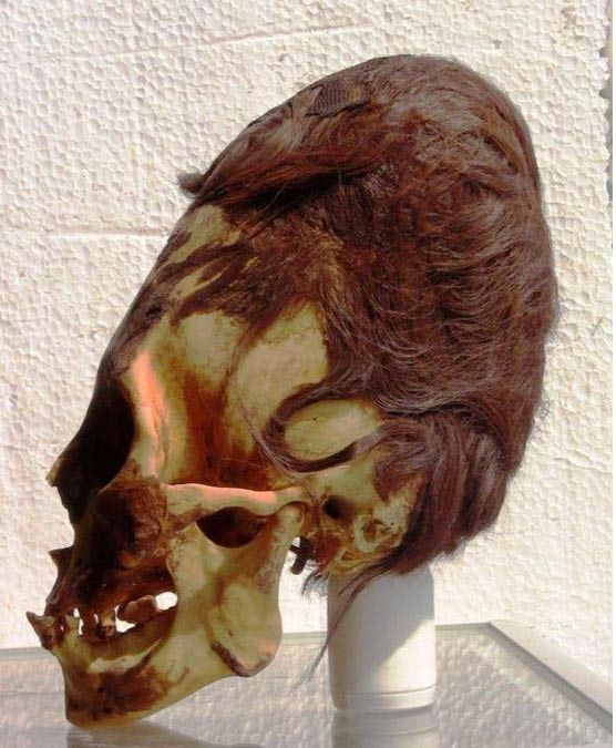 A Paracas skull with its red hair. Credit: Brien Foerster