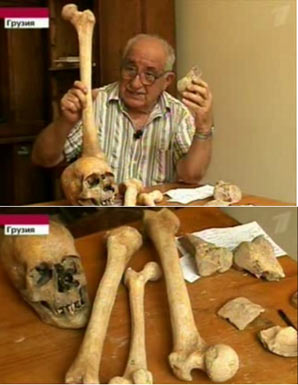 Bones found at the ancient site in Georgia