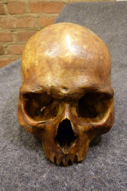 The cranium in the reliquary is said to be dented by one or two healed wounds that may have been due to weapons.