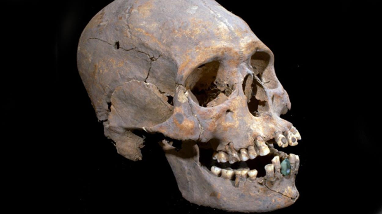 The elongated skull with stone encrusted teeth found in Teotihuacan, Mexico. 