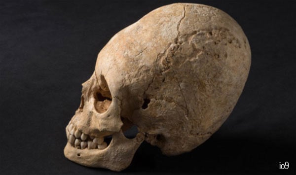 Image result for Elongated Peruvian Skulls May Have Been Elite Humans