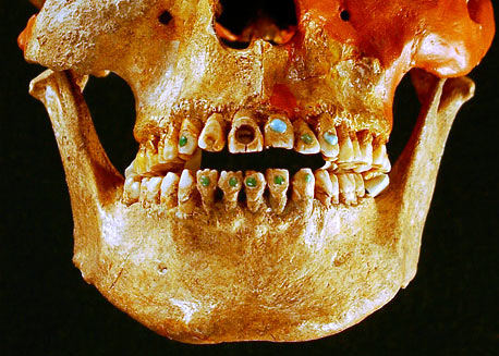 Mayan ‘bling’ on a male skull found in Chiapas, Mexico