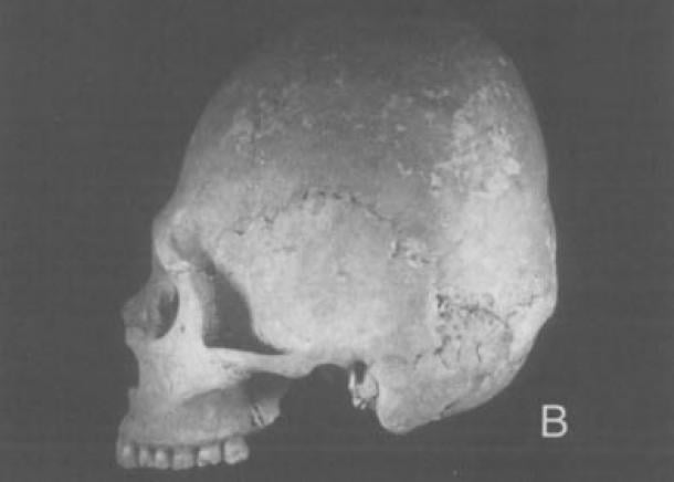  The Global Prehistoric Culture Ancient Earthworks of North America suggest pre-Columbian European contact Adena-like-crania