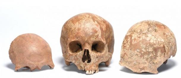 Adult skull of the Roman period, found at Liverpool Street