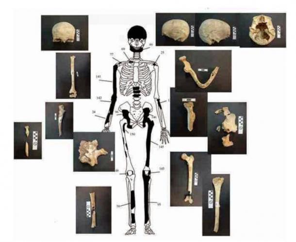 Inside the antechamber of the Amphipolis tomb  - Page 2 Bones-belonging-to-the-60-year-old-female