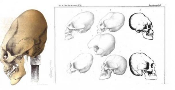 Elongated Skulls from Crimea, Baer 1860