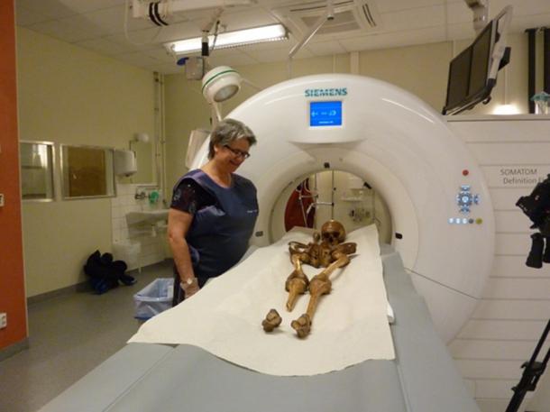 Examinations of the bones using computer tomography at the University Hospital in Uppsala found no discernible medical conditions.