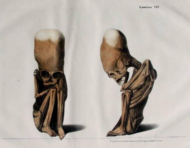 Elongated Skulls in utero: A Farewell to the Artificial Cranial Deformation Paradigm? Lithograph-elongated-skulls