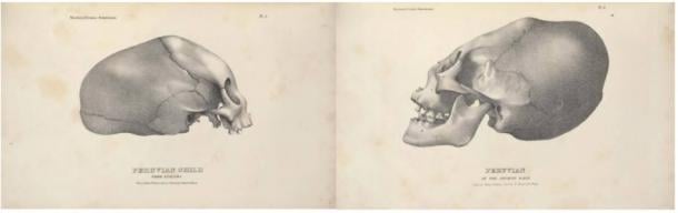 Elongated Skulls in utero: A Farewell to the Artificial Cranial Deformation Paradigm? Lithographs-by-John-Collins-elongated-skulls