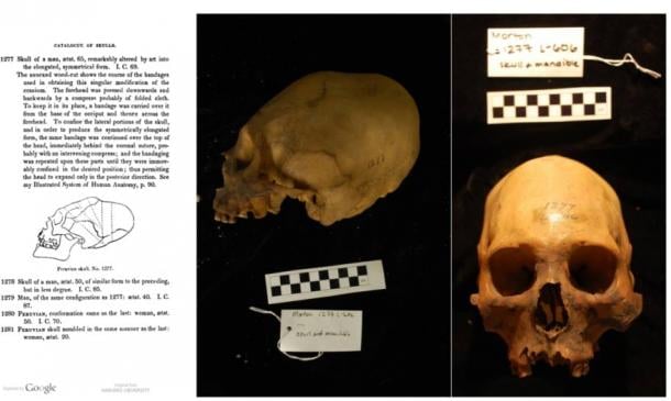 Elongated Skulls in utero: A Farewell to the Artificial Cranial Deformation Paradigm? Morton-Collection-Skull