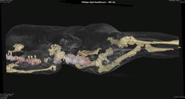 One of the Pompeii victim’s scan results, Italy.