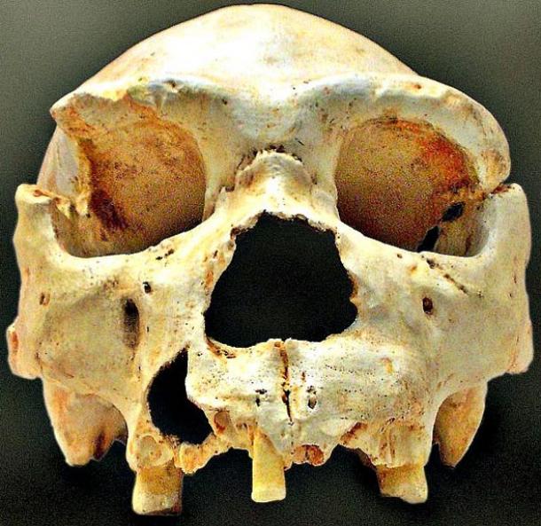 Skull number 5 of the Pit of Bones, as it appeared in the campaign of 1992. In later campaigns the jaw was exhumed. 