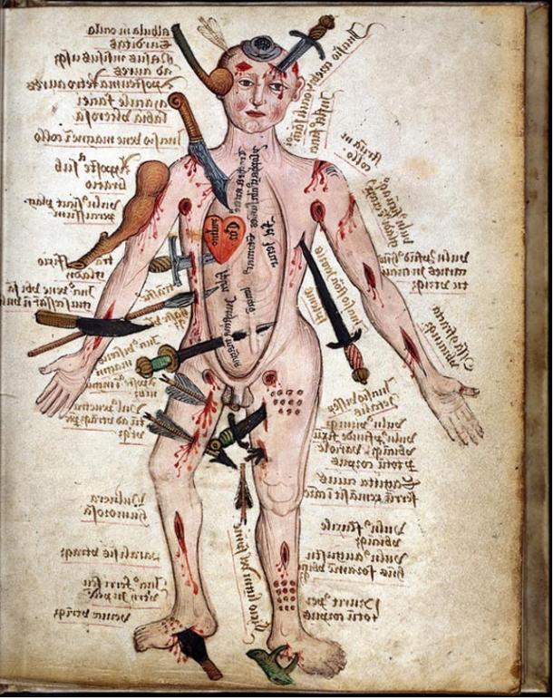 “Wound Man,” a medieval work attributed to Galen