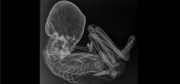 Peruvian child mummy with elongated skull undergoes analysis X-ray-of-the-Peruvian-mummy