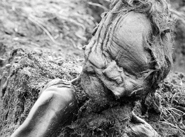 The body of the Grauballe Man upon his discovery.