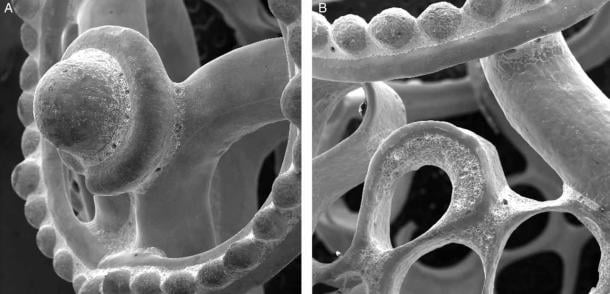 Imágenes de microscopio electrónico de barrido de la perla que muestran el trabajo detallado que entró en su construcción.