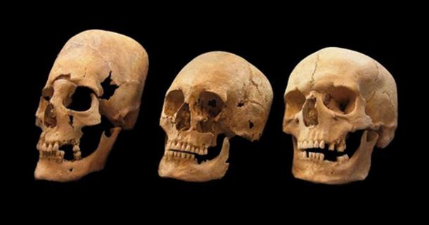 Bavarian skulls on the left and in the middle show signs of deformation; the one on the right is not deformed.