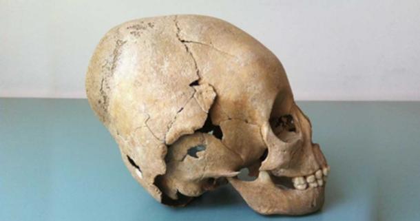 Example of a modified skull