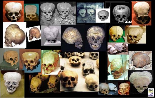 Image illustrating one of the "types" of elongated skulls