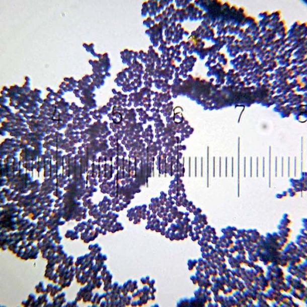 Unknown variety of Staphylococcus. 