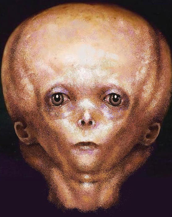 Художници изобразяват как би изглеждало детето след анализ на черепа на Starchild.  (tonio48 / Deviant Art)