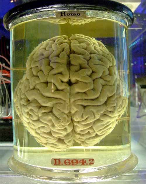 Human Brain in a Vat (Gaetan Lee / CC BY 2.0)
