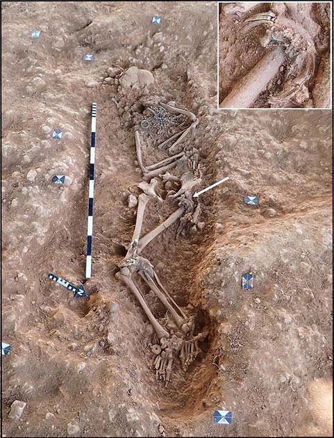 Burial of an Anglo-Saxon female unearthed in Scremby, Lincolnshire. The ivory ring bag was found at her left hip. (Hemer et. al  / Journal of Archaeological Science / CC BY-NC-ND 4.0)