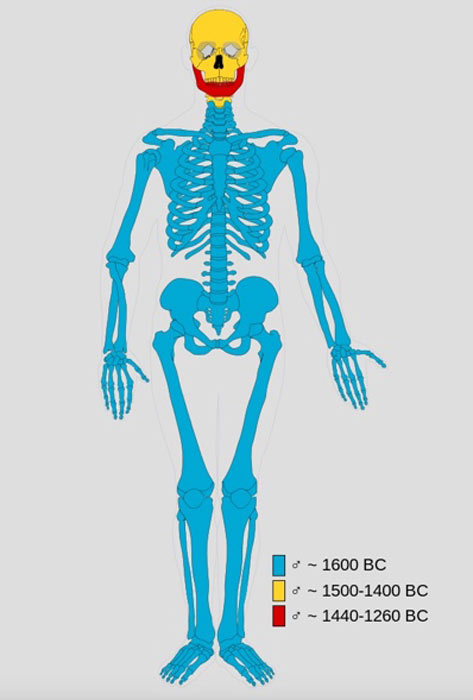 Las pruebas de ADN demuestran que las momias de Frankenstein están compuestas por diferentes esqueletos. Diagrama que muestra las partes que componen la momia masculina. El azul muestra partes de un macho adulto que data de 1600 aC, el amarillo un macho de 1500 a 1400 aC, y el rojo indica partes de un macho adulto que data de entre 1440 y 1360 aC. (Bullenwächter / CC BY-SA 3.0)