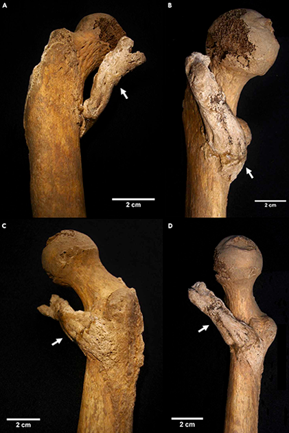 Detail of the curious bone growth found on the femur of an adult female in Constância, Portugal.  (©Sandra Assis/International Journal of Paleopathology)