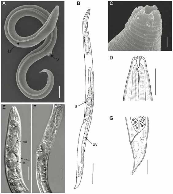 General morphology of P. kalamansis, female. Scanning electron pictures. (Halilovic et al, 2023, PLOS Genetics/CC-BY 4.0)