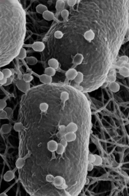 Imagen de microscopía de iones de helio que muestra el fago T4 que infecta a E. coli. Algunos de los fagos adheridos tienen colas movidas, lo que indica que han inyectado su ADN en el huésped E. coli. (Terry J. McGenity, Amare Gessesse, John E. Hallsworth, Esther García Cela, et al / CC BY-SA 4.0)