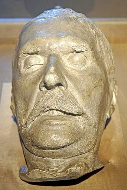 Death mask of Johann Strauss (Dennis Jarvis / CC by SA 2.0). Johann Strauss (1825 – 1899) was a famous Austrian composer who composed over 500 waltzes, polkas, quadrilles, and other types of dance music, as well as several operettas and a ballet. He was largely responsible for the popularity of the waltz in Vienna during the 19th century. He died of pneumonia, aged 73.