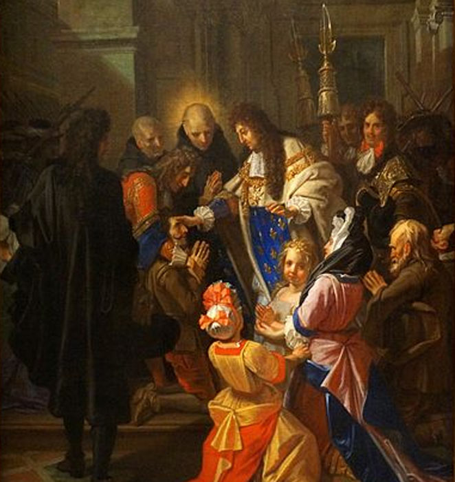Louis XIV applies the Royal Touch (G.Garitan / CC BY-SA 4.0)
