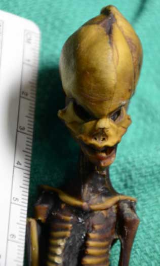 Mummified specimen from the Atacama region of Chile. Frontal view of the skull of the Ata specimen.