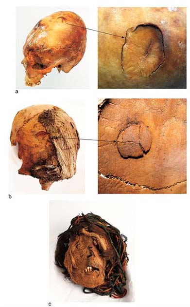 Perimortem cranium fractures, Formative Period. (Standen et al., 2023, PLOS ONE/CC-BY 4.0)
