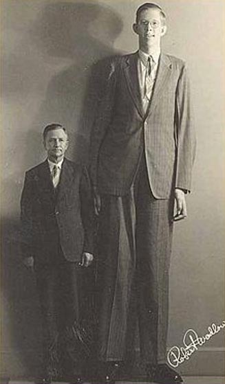 Robert Pershing Wadlow, tallest person in recorded history, was of a giant height due to hyperplasia of his pituitary gland. 