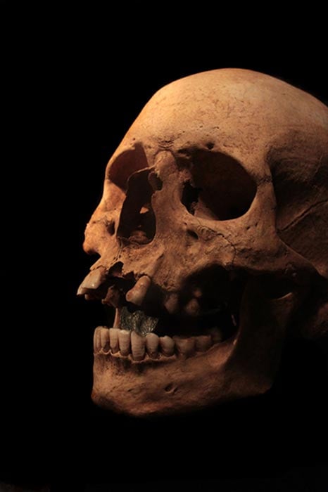 Roman skull with an obol (an Antoninus Pius dupondius) in the mouth. 