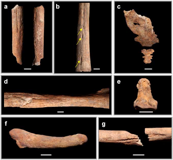 Selected skeletal elements from Individual 2 which show the extent and variety of the lesions and bone porosity. (Kalisher et al/PLoS ONE)