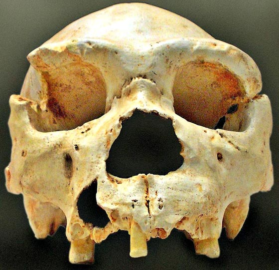 Skull number 5 of the Sima de los Huesos of Atapuerca, as it was discovered in the excavations of 1992. The jaw of this skull appeared, almost intact, years later, very near the site of the initial discovery.