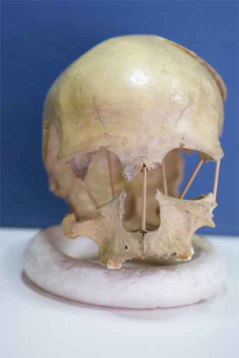 El cráneo de Peştera Muierii 1, cuyo genoma completo fue secuenciado como parte del estudio genético. (Mattias Jakobsson / Universidad de Uppsala)
