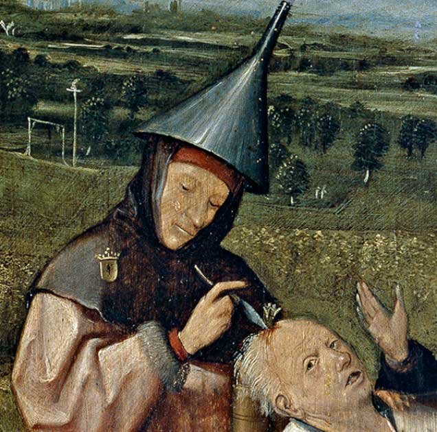 La extracción de la piedra de la locura, detalle de una pintura de Hieronymus Bosch que representa la trepanación, alrededor de 1488. (Dominio público)