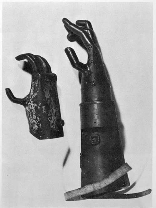 The prosthetic metal hand of Gottfried von Berlichingen