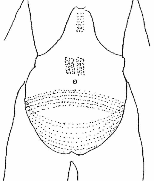 Detail of the abdominal tattoos visible on a Dynasty XI mummy of Amunet, from Fouquet, 1898 (Public Domain)