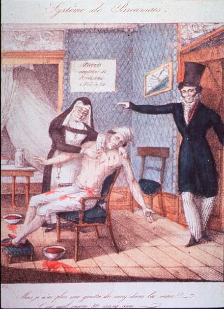 Una monja sangra a un paciente bajo la atenta mirada de un médico. La sangría como tratamiento médico continuó durante siglos, pero fue desacreditada en gran medida. (Dominio publico)
