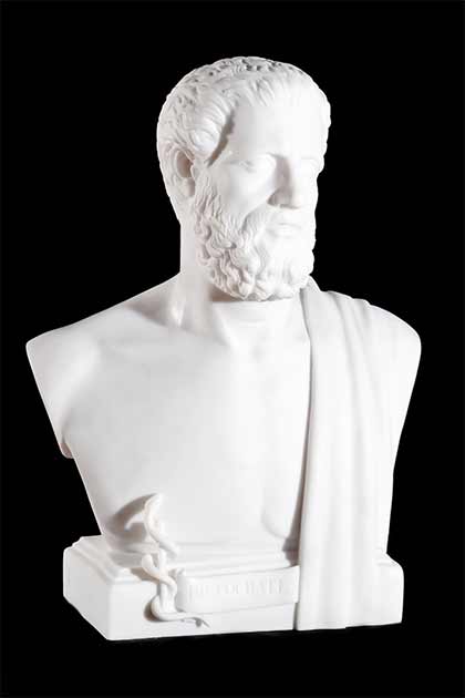 Un clásico busto de mármol blanco de Hipócrates aislado en un fondo negro. Más de mil años antes de la muerte del importante guerrero griego de la mandíbula alambrada, Hipócrates ya había escrito que el hilo de oro era perfecto para unir los huesos del rostro. (Mrakor/Adobe Stock)