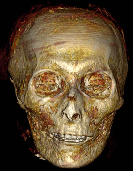 La reconstrucción facial completa del faraón Amenhotep I es inquietante y todavía nos deja preguntándonos cómo fue realmente su vida y quién era realmente. (S. Saleem y Z. Hawass / Frontiers in Medicine)