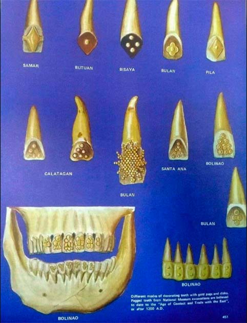 It was fashionable and prestigious back then to have your teeth filed and filled with gold. Early Philippine tradition includes dental modification as a type of personal styling and ornamentation (Philippine Story)